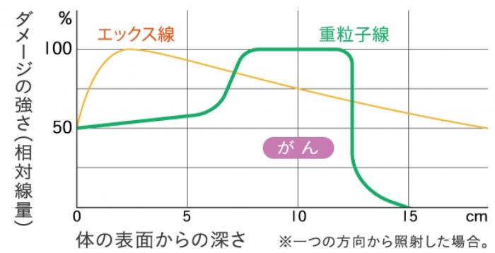 重粒子線とエックス線の線量分布の比較